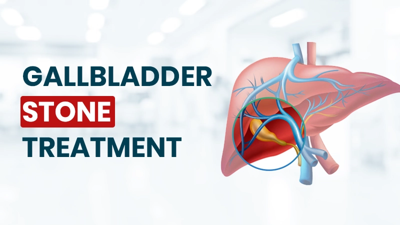 Which Size of Gallbladder Stone Is Dangerous Service